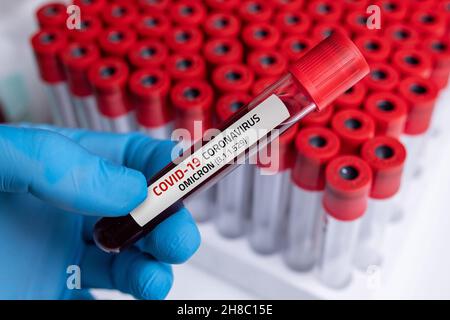 Arzt mit Blutprobe der Covid-19 Omicron B.1.1.529-Variante und allgemeinen Daten von Covid-19 Coronavirus-Mutationen. Stockfoto