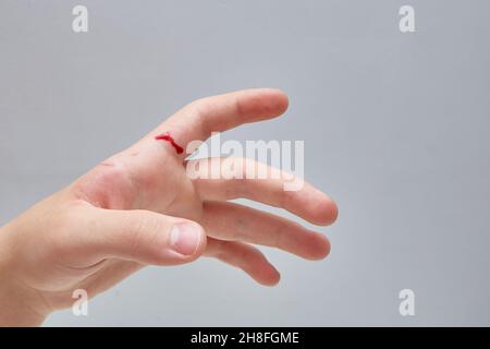 Blut auf der Hand. Ein Messerschnitt. Nahaufnahme. Kopierbereich, blauer Hintergrund Stockfoto