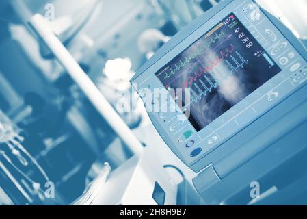 EKG-Kurven und Roentgen-Bild des Brustkorbs auf dem Monitor für die Lebenserhaltungs-Überwachung, während Ärzte den Patienten in der Notaufnahme retten. Stockfoto