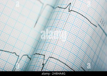 EKG-Linien auf dem gebogenen Diagrammpapier in Nahaufnahme. Stockfoto