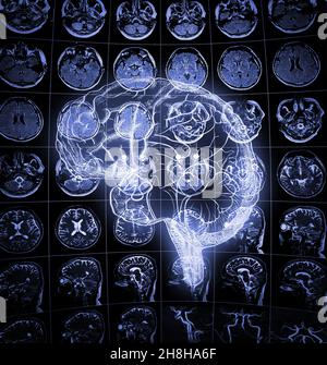 Leuchtende Zeichnung des menschlichen Gehirns auf dem Hintergrund des menschlichen Kopfscans. Stockfoto
