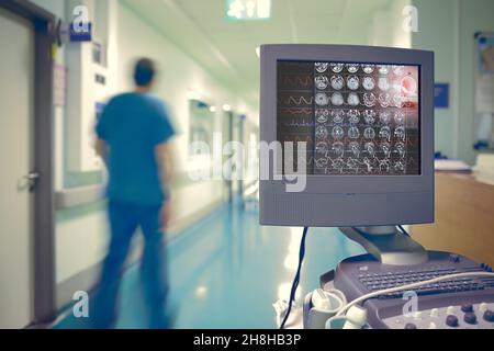 Medizinischer Monitor mit EKG und Hirnscan vor dem Hintergrund einer verschwommenen Silhouette eines männlichen Arztes, der durch den Krankenhausflur geht. Stockfoto