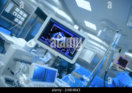 Ultraschallüberwachung des Herzens des Patienten während einer Herzoperation. Stockfoto