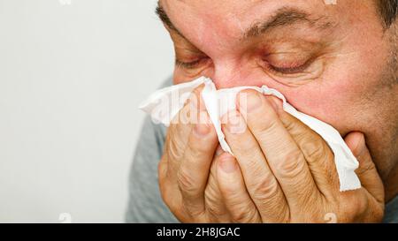 Ein Mann hat eine Erkältung und bläst seine Nase in ein Taschentuch Stockfoto