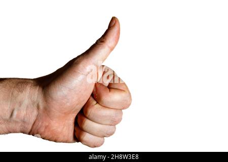 Hand mit Daumen Stockfoto