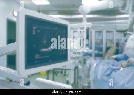 Ultraschallüberwachung der Herzfunktion im Operationssaal, ausgestattet mit fortschrittlichen Technologien, unfokussierter Hintergrund. Stockfoto
