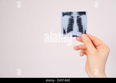 Eine Momentaufnahme eines Fluorogramms der Lunge in der Hand, Platz für Text. Stockfoto