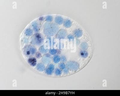 Eine protistische Mikrobe aus einer Wasserprobe, mit sichtbaren, blau gefärbten Lebensmittelvakuolen, Mikroskopiebild mit horizontalem Sichtfeld von etwa 121 Mikrometer Stockfoto