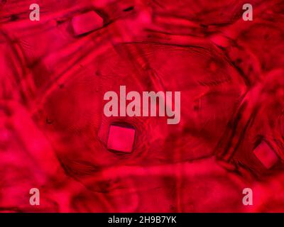 Rote Zwiebelhaut mit Oxalatkristallen unter dem Mikroskop, horizontales Sichtfeld ist etwa 0,24mm Stockfoto
