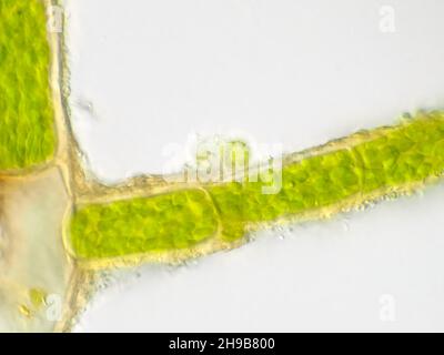 Pflanzenzellen unter dem Mikroskop, die Chlorophyllgehalt zeigen Stockfoto