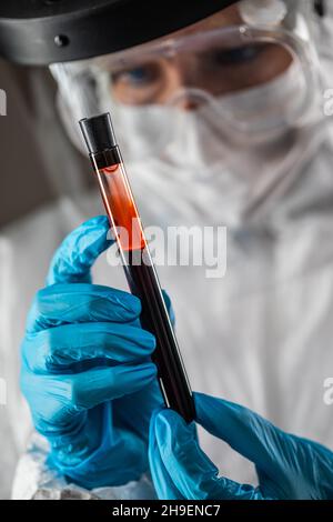 Laborarbeiterin hält Reagenzglas mit Blut Für Die Prüfung. Stockfoto