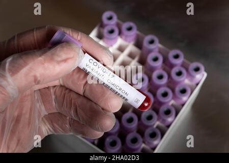 WHO covid-19 SARS-Varianten, die besorgniserregend oder interessant für Coronavirus sind, Blutprobe positives Ergebnis für Variante, die in Latexhandschuhen gehalten wird Stockfoto