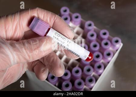 WHO covid-19 SARS-Varianten, die besorgniserregend oder interessant für Coronavirus sind, Blutprobe positives Ergebnis für Variante, die in Latexhandschuhen gehalten wird Stockfoto