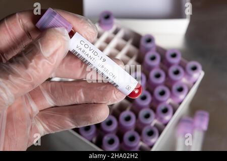 WHO covid-19 SARS-Varianten, die besorgniserregend oder interessant für Coronavirus sind, Blutprobe positives Ergebnis für Variante, die in Latexhandschuhen gehalten wird Stockfoto