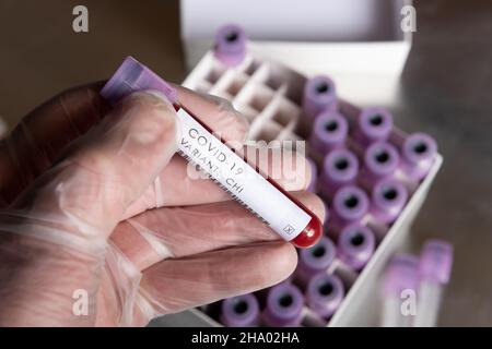 WHO covid-19 SARS-Varianten, die besorgniserregend oder interessant für Coronavirus sind, Blutprobe positives Ergebnis für Variante, die in Latexhandschuhen gehalten wird Stockfoto