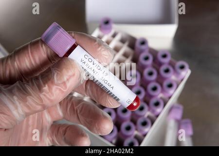 WHO covid-19 SARS-Varianten, die besorgniserregend oder interessant für Coronavirus sind, Blutprobe positives Ergebnis für Variante, die in Latexhandschuhen gehalten wird Stockfoto