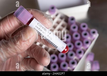 WHO covid-19 SARS-Varianten, die besorgniserregend oder interessant für Coronavirus sind, Blutprobe positives Ergebnis für Variante, die in Latexhandschuhen gehalten wird Stockfoto