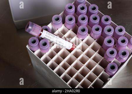 WHO covid-19 SARS-Varianten, die besorgniserregend oder interessant für Coronavirus sind, Blutprobe positives Ergebnis für Variante, die in Latexhandschuhen gehalten wird Stockfoto
