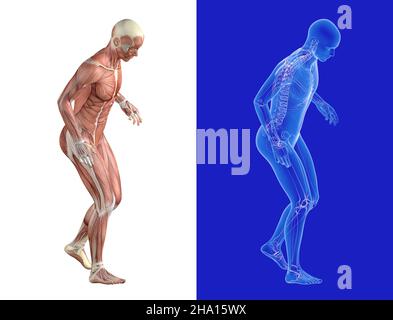 3D Darstellung von Schmerzen beim Gehen und Stützen des Fußes. Zwei anatomische Zwillingsbilder mit Muskeln und transparentem inneren Skelett. Stockfoto