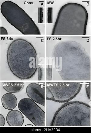 Vergleich von Raumtemperatur- und Kryo-Methoden Stockfoto