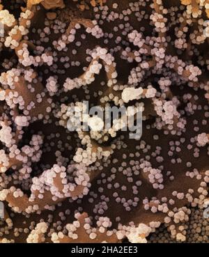 Eingefärbtes Rasterelektronenmikrograph einer Zelle (braun), die stark mit SARS-CoV-2-Viruspartikeln (hell) infiziert ist und von einem Patienten-sam isoliert wurde Stockfoto