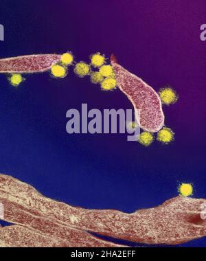 Neuartiges Coronavirus sars-COV-2 Stockfoto