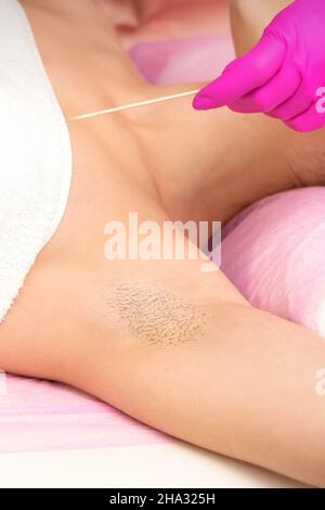Hand in Handschuh mit Spatel enthaart weibliche Achselhöhlen in einem Spa Stockfoto