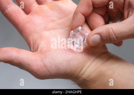 Die Hand eines Mannes reibt Schwielen mit einem Eiswürfel Stockfoto