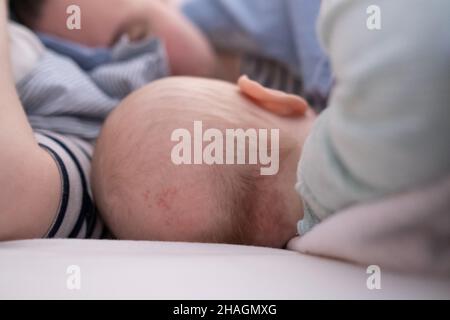 Kahler Fleck auf der Rückseite des Säuglingskopfs. Gerieben Haare des Kleinkindes Stockfoto