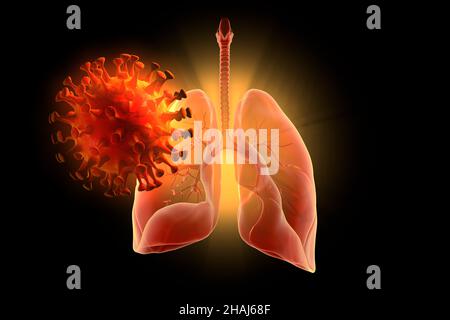 3D Abbildung mit Coronavirus und menschlicher Lunge. 3D Abbildung Stockfoto
