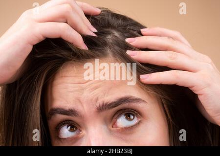 Nahaufnahme einer Frau, die ihre Haare und ihre Haare, Haarausfall am Haaransatz oder trockenes Kopfhautproblem untersucht. Stockfoto