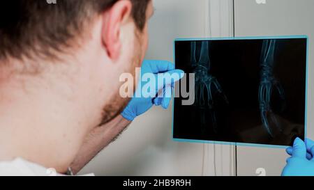 Röntgenverletzung des Handgelenks. Ein männlicher Arzt untersucht sorgfältig eine Handverletzung, ein Arzt betrachtet eine Röntgenaufnahme einer Knochenverletzung. Stockfoto