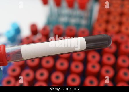 Reagenzglas mit einer Blutprobe und leerem Etikett. Stockfoto