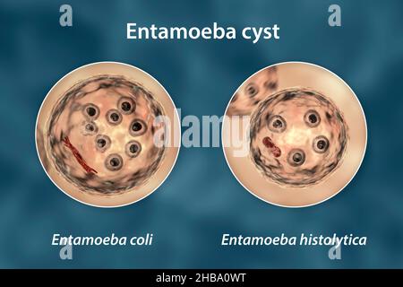 Zysten von Entamoeba-Protozoen, E. coli und E. histolityca, Computerdarstellung. E. coli ist eine nicht pathogene Amöbe, seine Zyste beträgt 15-25 Mikrometer, hat acht Kerne und einen chromatoidalen Balken, der mit splitterten Enden (dunkelrot) verlängert ist. E. histolytica ist ein parasitäres Protozoon, das beim Menschen nach der Einnahme von infektiösen Zysten in kontaminierten Lebensmitteln oder Wasser eine amöbische Dysenterie verursacht. Die reife Zyste von E. histolytica ist 10-20 Mikrometer groß, hat vier Kerne und einen gerundeten länglichen chromatoidalen Balken (dunkelrot). Stockfoto