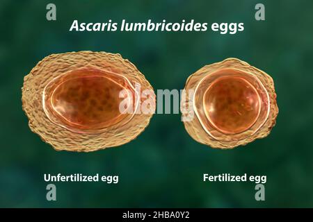 Illustration der unbefruchteten und befruchteten Eier von Ascaris lumbricoides, einem großen Rundwurm. Stockfoto