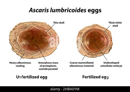 Illustration der unbefruchteten und befruchteten Eier von Ascaris lumbricoides, einem großen Rundwurm. Stockfoto