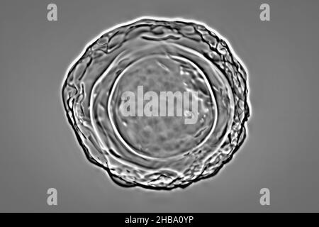 Befruchtete Eier von Ascaris lumbricoides, Illustration. Die Eier haben eine dicke Schutzhülle, diese dickgeschälten Eier können ungünstige Bedingungen der Dürre überleben, im Boden begraben. Der Erwachsene Wurm (bis zu 35cm lang) ist ein Darmparasit des Menschen. Befall kann Bauchschmerzen, Erbrechen, Verstopfung, Mangelernährung und Anämie verursachen. Der weibliche Wurm legt große Mengen von Eiern in den menschlichen Darm, die in den Kot ausgeschieden und von einem neuen Wirt über kontaminiertes Wasser oder Nahrung aufgenommen werden. Diese Infektion wird als Aszariasis bekannt. Stockfoto