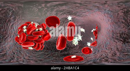 Blutgerinnsel aus roten Blutkörperchen, Blutplättchen und Fibrin-Eiweißsträngen. 360 Grad VR-Panoramaansicht, Illustration. Stockfoto