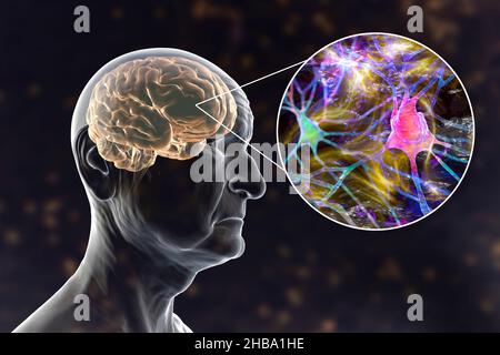 Demenz und Alzheimer-Krankheit, konzeptuelle Computerdarstellung. Gedächtnisverlust, Gehirnalterung und fortschreitende Beeinträchtigung der Hirnfunktionen bei älteren Menschen. Stockfoto