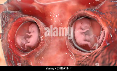 Multiple Schwangerschaft, Illustration. Dizygotische Zwillinge entwickeln sich in Woche 8 getrennt in der Gebärmutter. Stockfoto