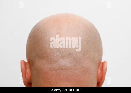 Rasierte Kopfrückseite. Skinhead. Glatze. Stockfoto