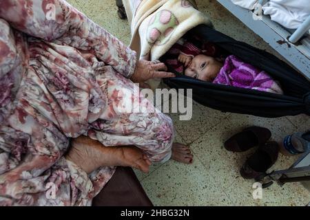 Indira Gandhi Kinderkrankenhaus in Kabul ist ein Kinderkrankenhaus in Afghanistan. Kinder unter 5 Jahren, die an Unterernährung leiden, werden ins Krankenhaus eingeliefert. Stockfoto