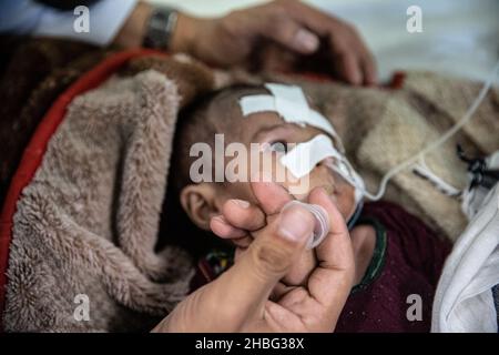 Indira Gandhi Kinderkrankenhaus in Kabul ist ein Kinderkrankenhaus in Afghanistan. Kinder unter 5 Jahren, die an Unterernährung leiden, werden ins Krankenhaus eingeliefert. Stockfoto