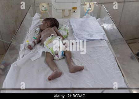 Indira Gandhi Kinderkrankenhaus in Kabul ist ein Kinderkrankenhaus in Afghanistan. Kinder unter 5 Jahren, die an Unterernährung leiden, werden ins Krankenhaus eingeliefert. Stockfoto