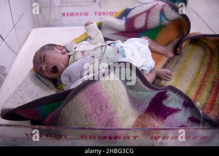 Indira Gandhi Kinderkrankenhaus in Kabul ist ein Kinderkrankenhaus in Afghanistan. Kinder unter 5 Jahren, die an Unterernährung leiden, werden ins Krankenhaus eingeliefert. Stockfoto