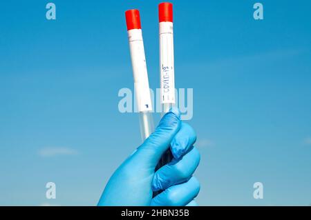 Reagenzgläser und Ergebnisse biochemischer Tests auf Viren und Bakterien Stockfoto