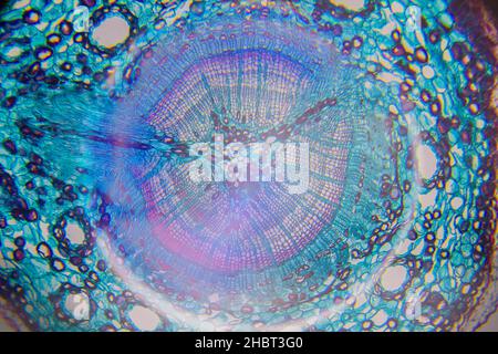 Mikroskopie einer Baumzelle Stockfoto