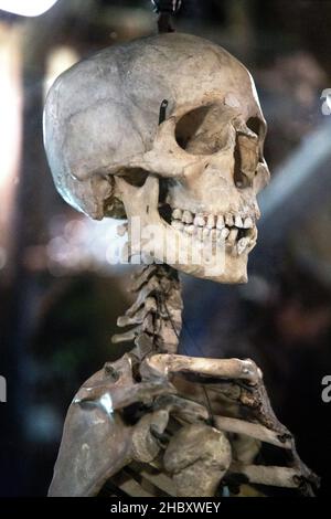 Menschliches Skelett, Nahaufnahme des Schädels (Old Operate Theatre Museum und Herb Garret, London, Großbritannien Stockfoto