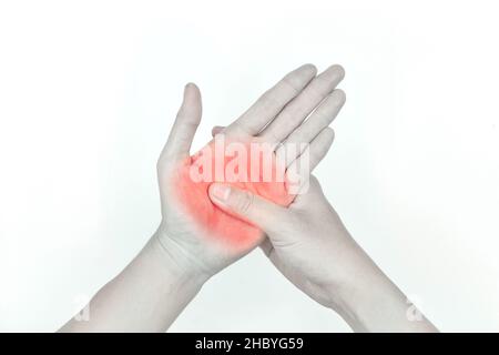 Schmerzhafter Palmar-Aspekt des asiatischen jungen Mannes. Konzept des Kompartiment-Syndroms, Zellulitis und Schmerzen der Handmuskulatur. Stockfoto
