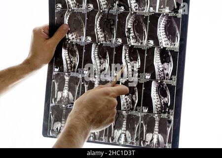 MRT-Röntgenaufnahme von Rücken und Hand eines Arztes in einem Krankenhaus. Diagnostik und Behandlung, Gesundheitskonzept. Hochwertige Fotos Stockfoto